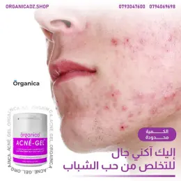 Acne-Gel للدسة و حب الشباب